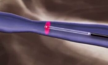 Θερμικές θεραπείες