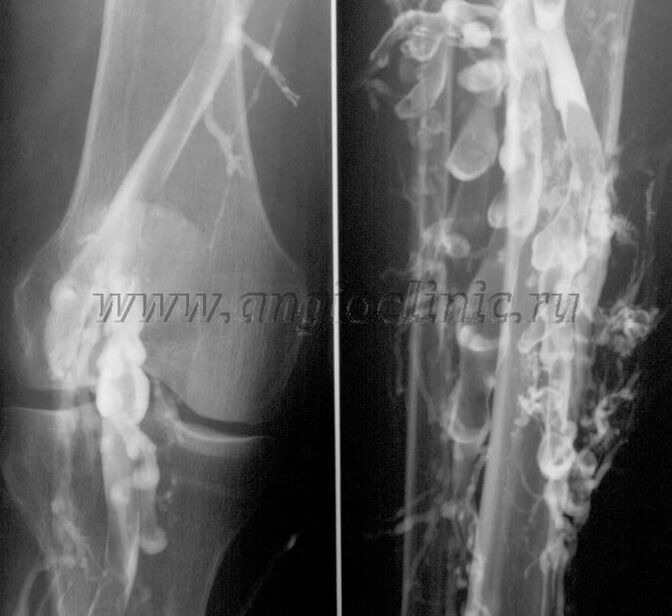 Υπερηχογραφική εξέταση